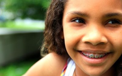 5 Ways to Make Your Teeth Look Whiter During Orthodontic Treatment