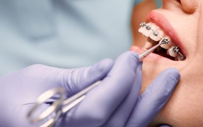 How Do I Choose An Orthodontist?