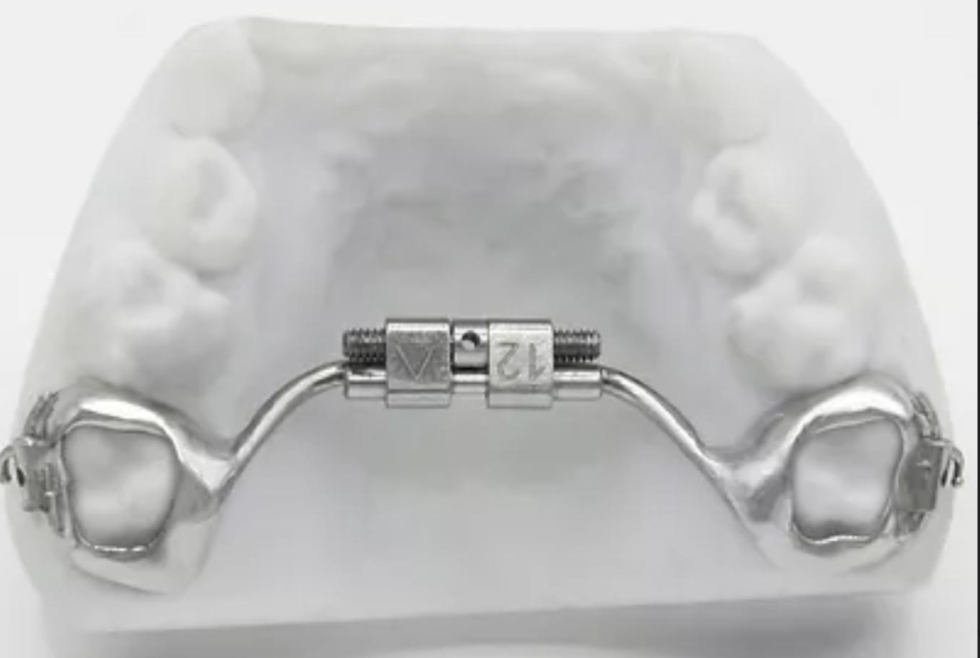 3 Reasons 3D Printed Expanders are Better Orthodontist Canton, MI