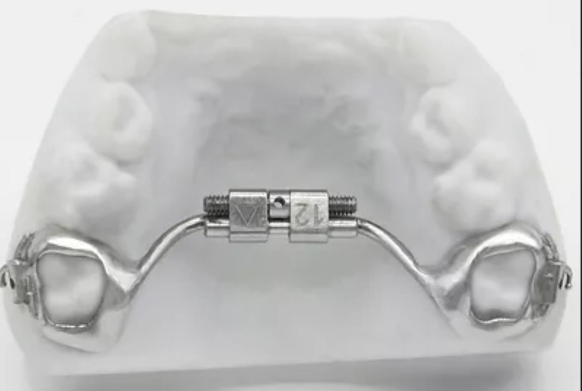 3 Reasons 3D Printed Expanders are Better - Orthodontist Canton, MI